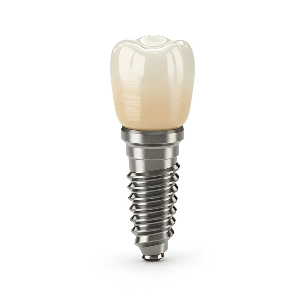 dental implants near you